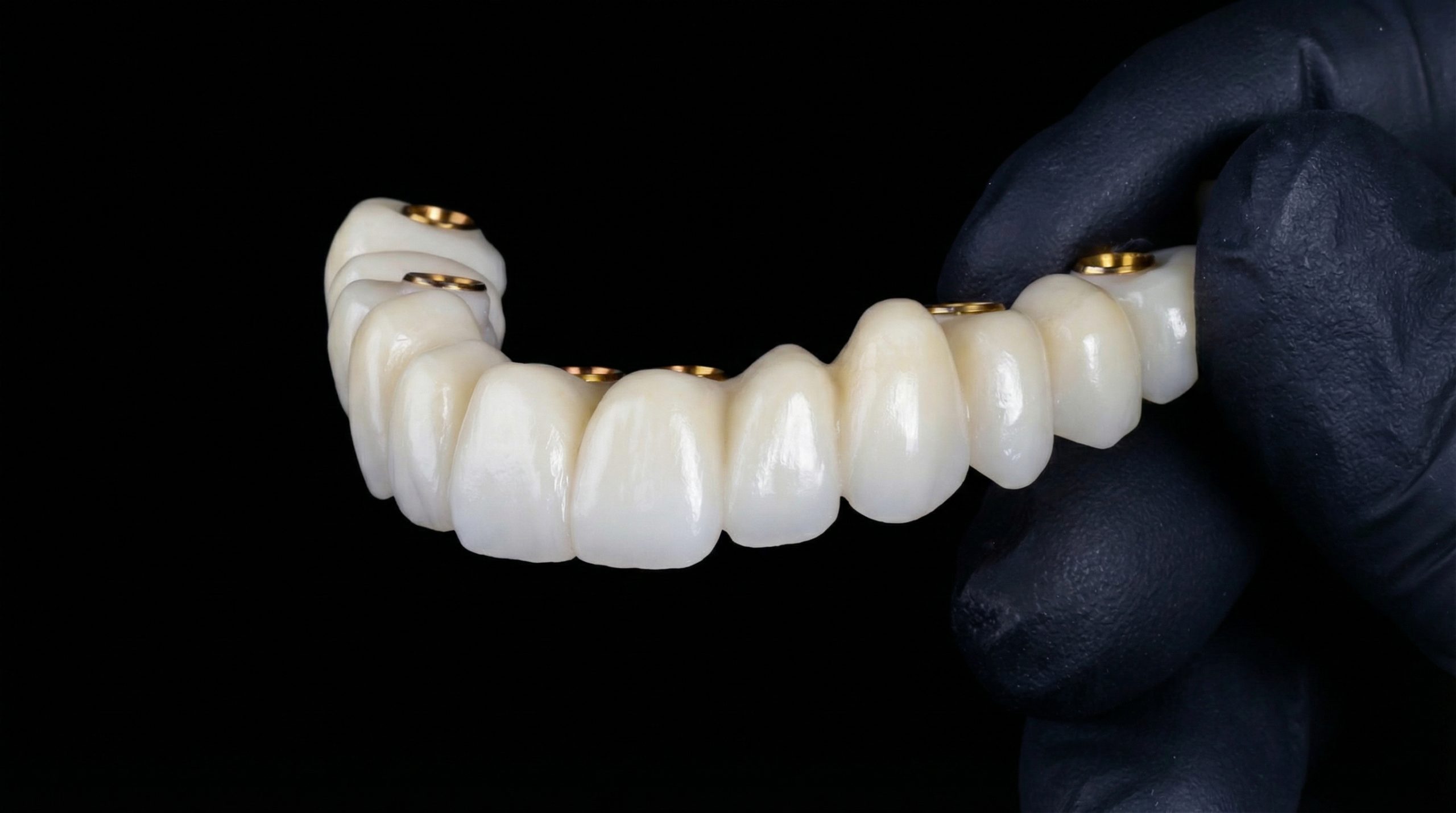 dentadura fija sobre implantes dentales